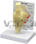 Basic Knee Joint Model w/ Anatomy Education Card